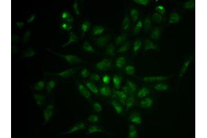 Immunofluorescence analysis of HeLa cell using SELPLG antibody. (SELPLG anticorps)