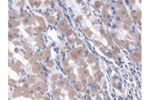 DAB staining on IHC-P; Samples: Human Stomach Tissue (NARS anticorps  (AA 1-330))