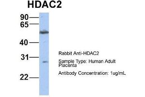 Host:  Rabbit  Target Name:  HDAC2  Sample Type:  Human Adult Placenta  Antibody Dilution:  1. (HDAC2 anticorps  (Middle Region))