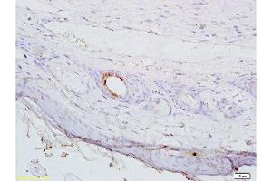 Formalin-fixed and paraffin embedded mouse cancer tissue labeled with Anti-AGPAT4 Polyclonal Antibody, Unconjugated  at 1:200 followed by conjugation to the secondary antibody, (SP-0023), and DAB staining