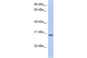 HAVCR2 antibody used at 1 ug/ml to detect target protein.