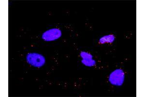Proximity Ligation Analysis of protein-protein interactions between GAB1 and CRKL.