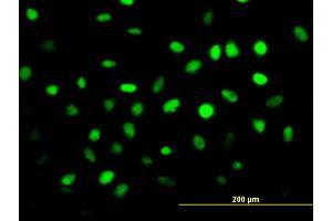 Immunofluorescence of monoclonal antibody to ZNF24 on HeLa cell.