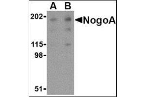 Western blot analysis of NogoA in human brain tissue lysate with this product at (A) 0. (Reticulon 4 anticorps  (Isoform 1))