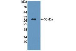 Detection of Recombinant LAG3, Rat using Polyclonal Antibody to Lymphocyte Activation Gene 3 (LAG3) (LAG3 anticorps  (AA 209-451))
