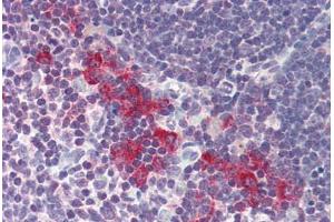 Human Thymus (formalin-fixed, paraffin-embedded) stained with DNASE2 antibody ABIN214485 at 5 ug/ml followed by biotinylated goat anti-rabbit IgG secondary antibody ABIN481713, alkaline phosphatase-streptavidin and chromogen. (DNASE2 anticorps  (AA 347-360))