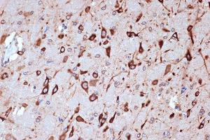 Immunohistochemistry of paraffin-embedded rat brain using PRKRA/PACTRabbit mAb (ABIN7269666) at dilution of 1:100 (40x lens). (PRKRA anticorps)
