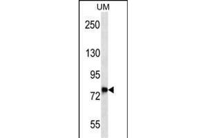 DNAJC14 Antibody (Center) (ABIN657070 and ABIN2846233) western blot analysis in uterus tumor cell line lysates (35 μg/lane). (DNAJC14 anticorps  (AA 184-213))