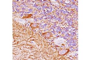 Human cerebellum stained with Neurofilament antibody (NF421). (Neurofilament anticorps)