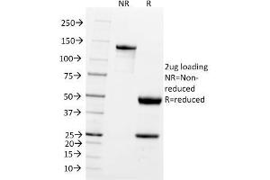 SDS-PAGE Analysis Purified Pgp9.