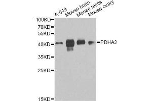 Western blot analysis of extracts of various cell lines, using PDHA2 antibody (ABIN6003651) at 1/1000 dilution. (PDHA2 anticorps)