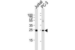 Western blot analysis of lysate from human Jurkat and rat PC-3 lysate using HMGB4 antibody diluted at 1:1000. (HMGB4 anticorps  (AA 45-73))