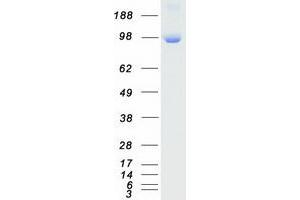 Validation with Western Blot