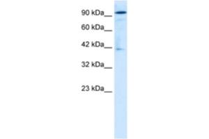 Western Blotting (WB) image for anti-OTU Domain Containing 7B (OTUD7B) antibody (ABIN2460998)
