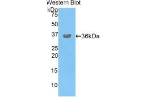 Detection of Recombinant PDHb, Human using Polyclonal Antibody to Pyruvate Dehydrogenase Beta (PDHb) (PDHB anticorps  (AA 31-341))