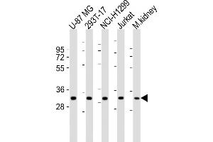 All lanes : Anti-FN3KRP Antibody (N-Term) at 1:1000-1:2000 dilution Lane 1: U-87 MG whole cell lysates Lane 2: 293T-17 whole cell lysates Lane 3: NCI- whole cell lysates Lane 4: Jurkat whole cell lysates Lane 5: mouse kidney lysates Lysates/proteins at 20 μg per lane. (FN3KRP anticorps  (AA 24-58))