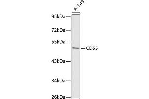 Western blot analysis of extracts of A-549 cells, using CD55 antibody (ABIN6130080, ABIN6138206, ABIN6138207 and ABIN6218089) at 1:1000 dilution. (CD55 anticorps  (AA 40-300))