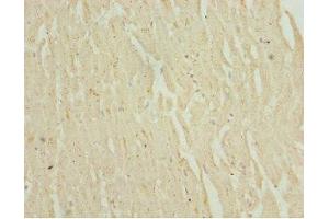 Immunohistochemistry of paraffin-embedded human heart tissue using ABIN7151087 at dilution of 1:100