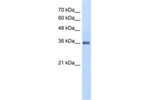 Western Blotting (WB) image for anti-Phosphatidic Acid Phosphatase Type 2A (PPAP2A) antibody (ABIN2462626)