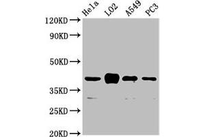 Western Blot Positive WB detected in: Hela whole cell lysate, LO2 whole cell lysate, A549 whole cell lysate, PC-3 whole cell lysate All lanes: VN1R1 antibody at 3. (VN1R1 anticorps  (AA 1-56))