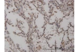 Immunoperoxidase of monoclonal antibody to FOXL1 on formalin-fixed paraffin-embedded human lung.