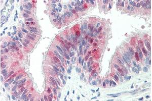 ABIN335141 (5µg/ml) staining of paraffin embedded Human Lung. (ZDHHC13 anticorps  (C-Term))