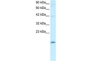 WB Suggested Anti-APOBEC3G Antibody Titration:  0. (APOBEC3G anticorps  (N-Term))