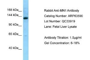 Western Blotting (WB) image for anti-MN1 proto-oncogene (MN1) (C-Term) antibody (ABIN2789559) (Meningioma 1 anticorps  (C-Term))