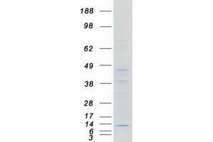 Validation with Western Blot