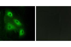 Peptide - +Immunohistochemistry analysis of paraffin-embedded human colon carcinoma tissue, using ES8L3 antibody. (EPS8-Like 3 anticorps)