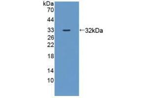 Western blot analysis of recombinant Mouse ZRF1. (DNAJC2 anticorps  (AA 368-621))