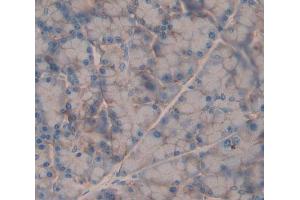 Used in DAB staining on fromalin fixed paraffin- embedded Kidney tissue