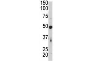 Western blot of PDK4 antibody and mouse skeletal muscle tissue lysate.