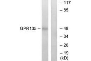 Western Blotting (WB) image for anti-G Protein-Coupled Receptor 135 (GPR135) (AA 371-420) antibody (ABIN2890845) (GPR135 anticorps  (AA 371-420))