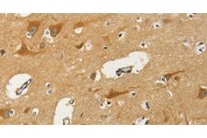 Immunohistochemistry of paraffin-embedded Human brain using KLC1 Polyclonal Antibody at dilution of 1:40 (KLC1 anticorps)