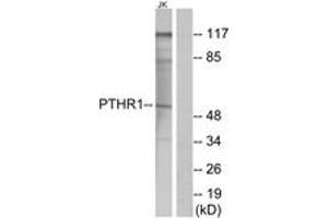 Western blot analysis of extracts from Jurkat cells, using PTHR1 Antibody. (PTH1R anticorps  (AA 145-194))
