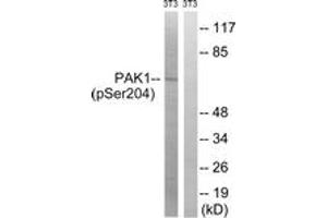 Western blot analysis of extracts from NIH-3T3 cells treated with UV 15', using PAK1 (Phospho-Ser204) Antibody. (PAK1 anticorps  (pSer204))