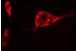 ABIN6275045 staining Hela cells by IF/ICC. (ATG4C anticorps  (N-Term))