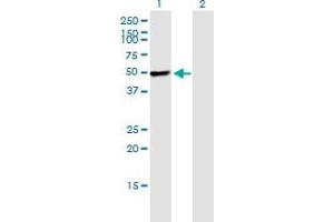 Western Blot analysis of PIK3R1 expression in transfected 293T cell line by PIK3R1 monoclonal antibody (M02), clone 1C10. (PIK3R1 anticorps  (AA 1-454))