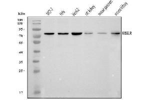 Western blot analysis of GPR54/KISS1R using anti-GPR54/KISS1R antibody (ABIN7602153). (KISS1R anticorps  (AA 60-373))