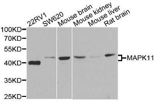 Western blot analysis of extracts of various cell lines, using MAPK11 antibody. (MAPK11 anticorps)