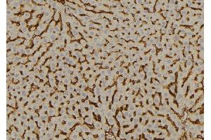 ABIN6277613 at 1/100 staining Mouse liver tissue by IHC-P.