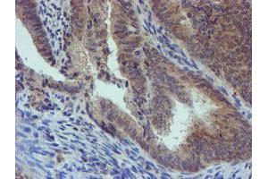 Image no. 8 for anti-Phosphoglucomutase 3 (PGM3) antibody (ABIN1500178) (Phosphoglucomutase 3 anticorps)