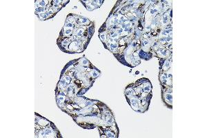 Immunohistochemistry of paraffin-embedded human placenta using RanG Rabbit pAb (ABIN6128613, ABIN6146681, ABIN6146683 and ABIN6217306) at dilution of 1:50 (40x lens).