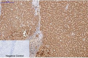 Immunohistochemical analysis of paraffin-embedded human liver tissue. (HSV Tag anticorps)