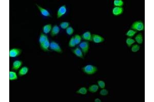 Immunofluorescence staining of Hela cells with ABIN7152961 at 1:100, counter-stained with DAPI. (BLVRB anticorps  (AA 2-206))