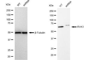 Western blotting analysis using IRAK3 antibody (ABIN7799115).