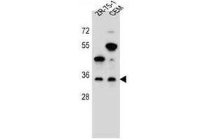 GPM6B Antibody (N-term) western blot analysis in ZR-75-1,CEM cell line lysates (35µg/lane). (GPM6B anticorps  (N-Term))