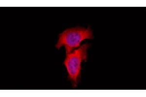 ABIN6262447 and ABIN6266925 staining Hela by IF/ICC.