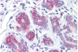 Human Breast: Formalin-Fixed, Paraffin-Embedded (FFPE)